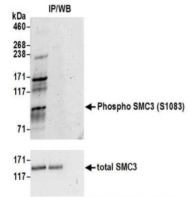 Immunoprecipitation: SMC3 [p Ser103] Antibody [NBP2-37694]